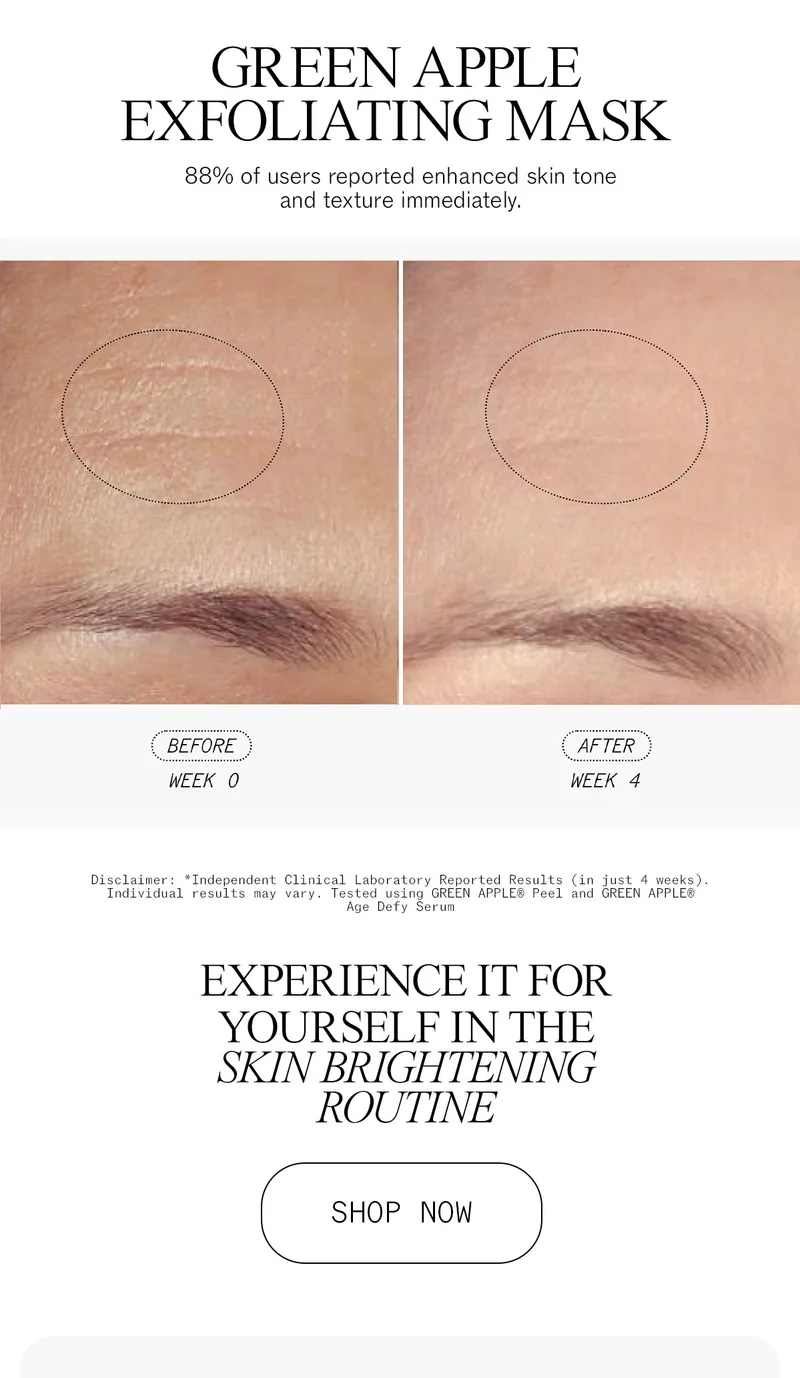 Experience Clinically Validated Results with Green Apple Peel in the Skin Brightening Routine