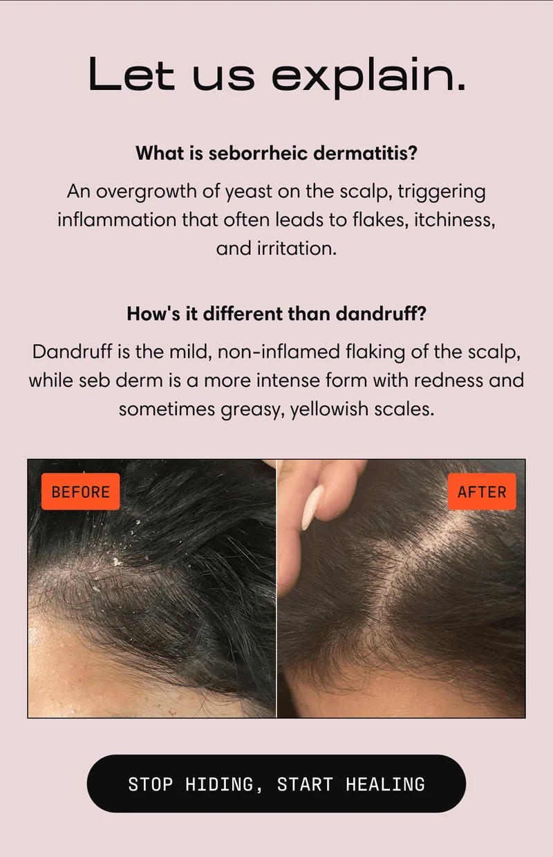 Let us explain. | What is seborrheic dermatitis? An overgrowth of yeast on the scalp, triggering inflammation that often leads to flakes, itchiness, and irritation. | How's it different than dandruff? Dandruff is the mild, non-inflamed flaking of the scalp, while seb derm is a more intense form with redness and sometimes greasy, yellowish scales. | STOP HIDING, START HEALING