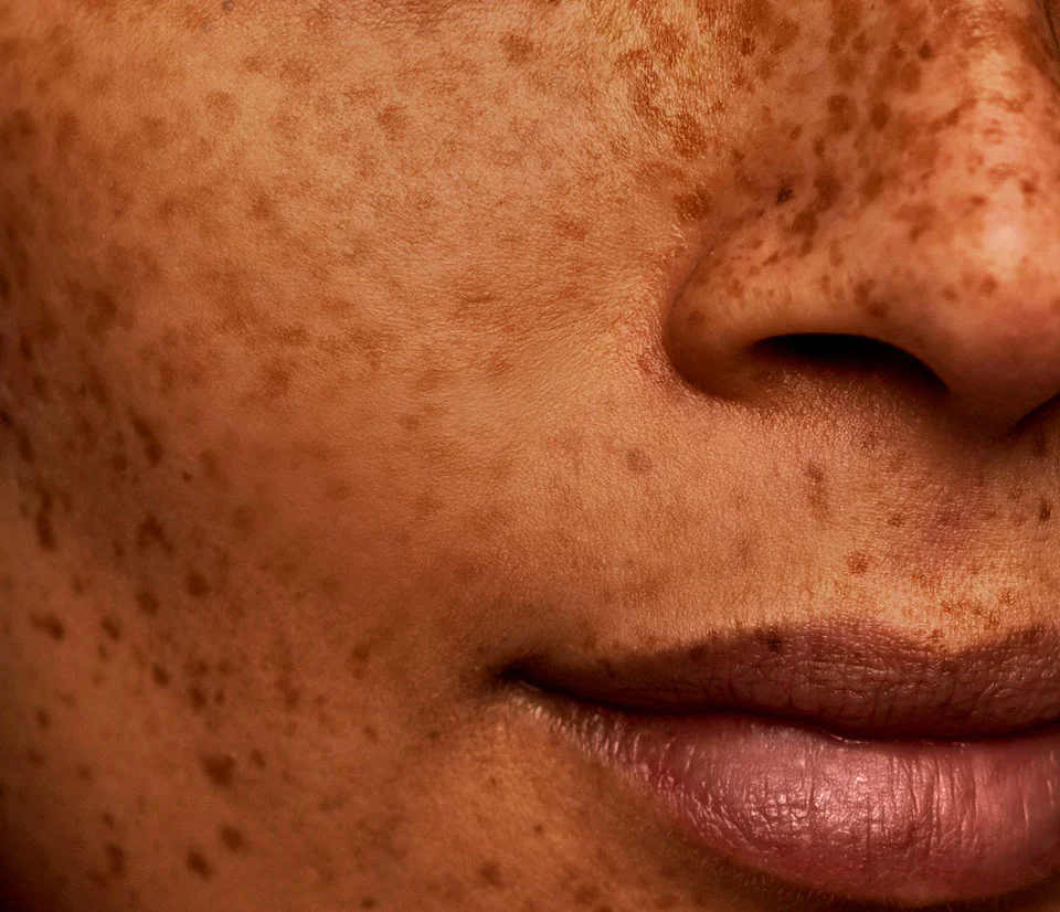 Skin Health