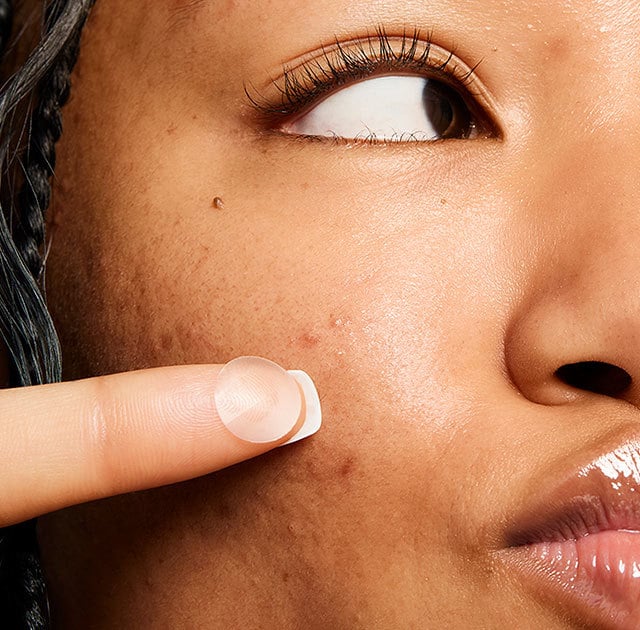 Step 2: Zit gone