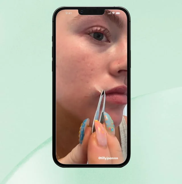 User applying Stick It to Zits Pimple Patches