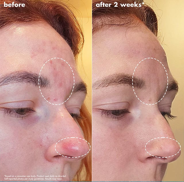 before & after