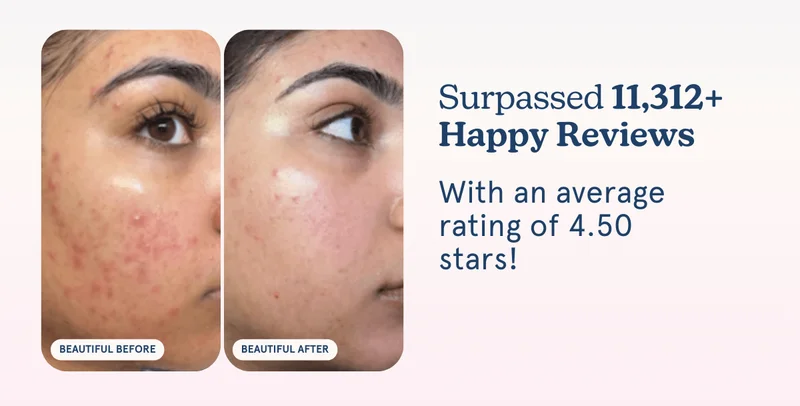 Surpassed 11,312+ Happy Reviews With an average rating of 4.50 stars!