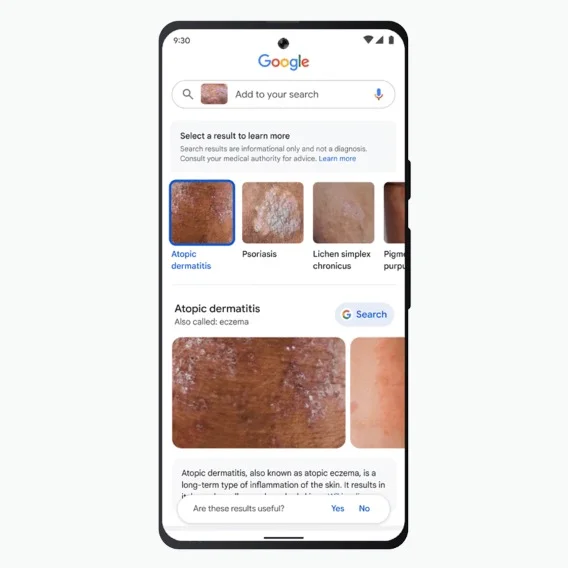 A Pixel phone showing a Google Search results page for a visual Lens search for a skin condition.