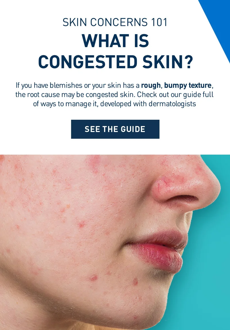 Skin Concerns