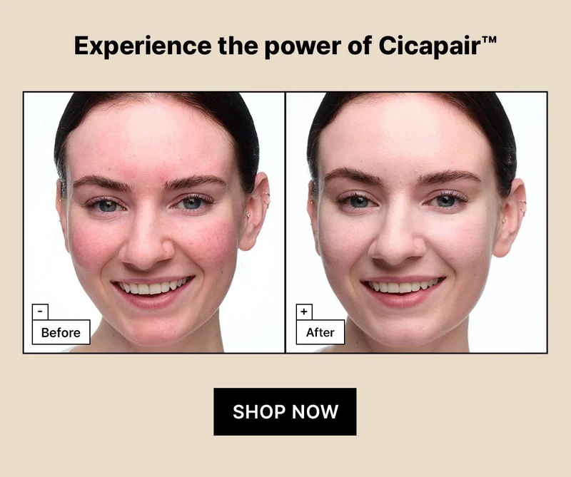 Calling all sensitive skin types. Get 3 free Cicapair full sizes with orders $65+.