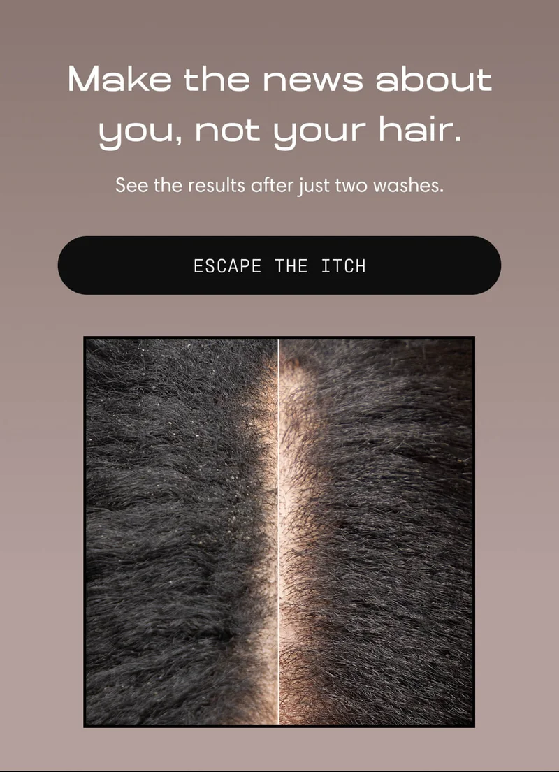 Make the news about you, not your hair | See results after just two washes | escape the itch