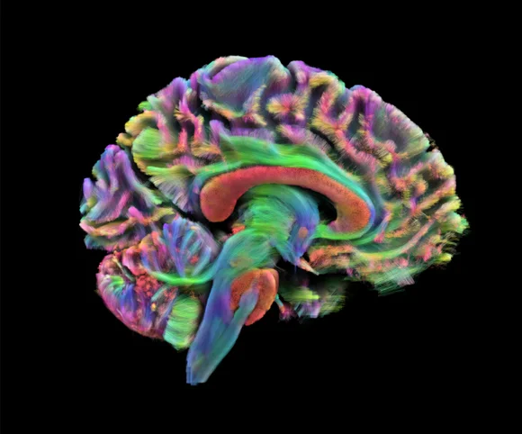 Colored diffusion tensor imaging reveals the brain’s white-matter highways, which carry signals between regions.