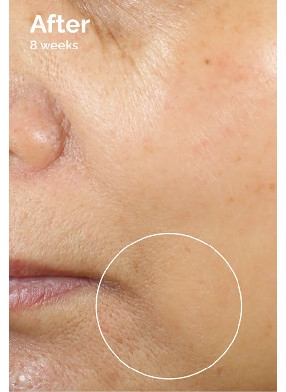 After 8 weeks using  Caffeine 3% + Escin 1% Face Serum
