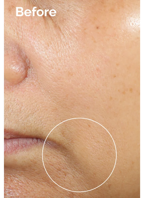 Before using Caffeine 3% + Escin 1% Face Serum