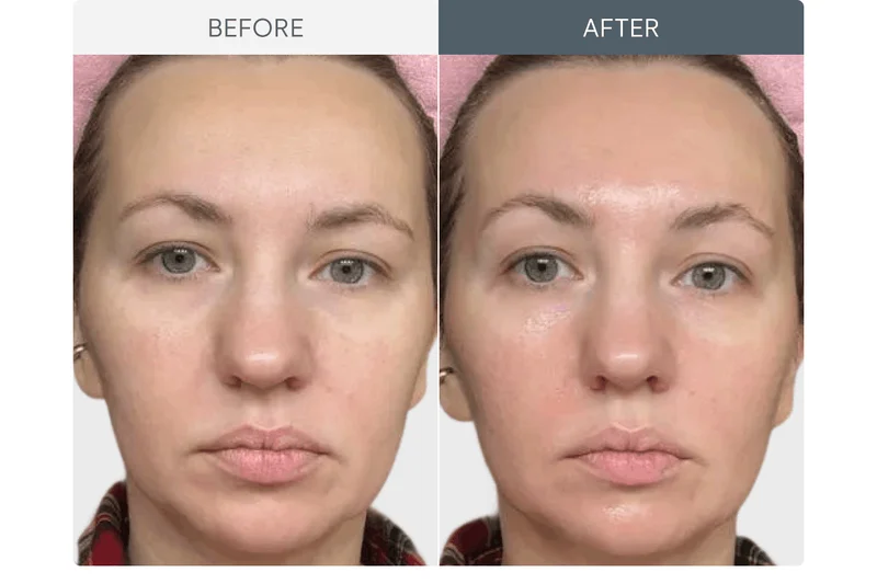 Before & After Showcase