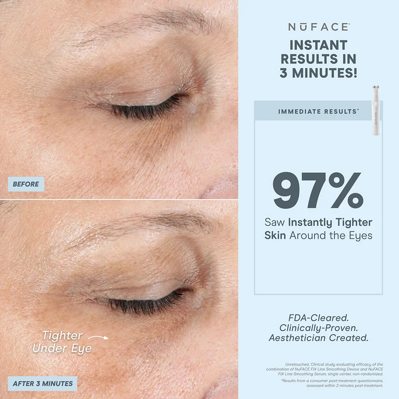 Before and after showcasing instantly tighter skin around the eyes after using the FIX Line Smoothing Device.