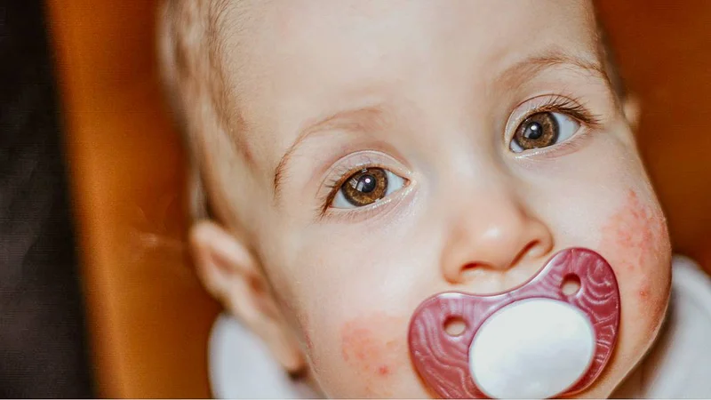 The Best Products to Tackle Your Baby's Common Skin Conditions