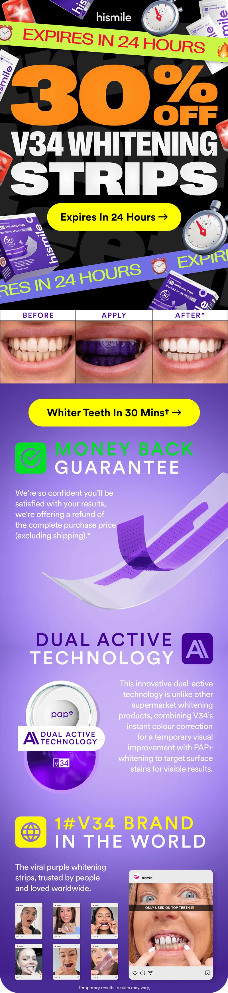 Expires in 24 hours! 30% OFF V34 Whitening Strips!