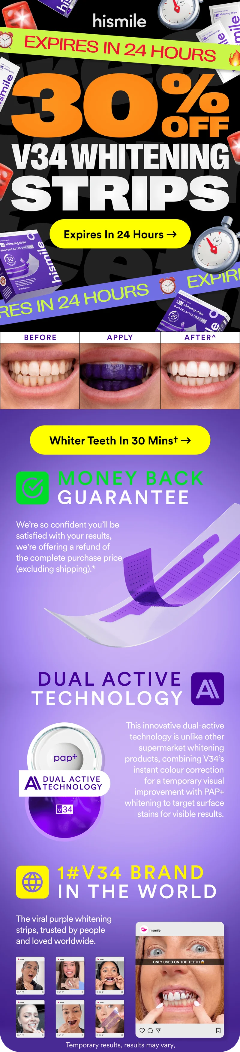 Expires in 24 hours! 30% OFF V34 Whitening Strips!
