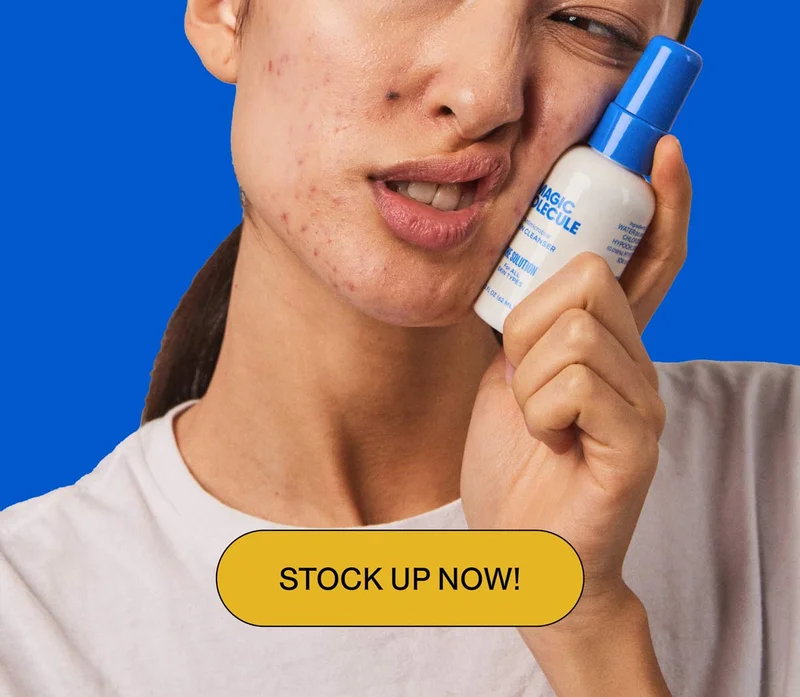 STOCK UP NOW!