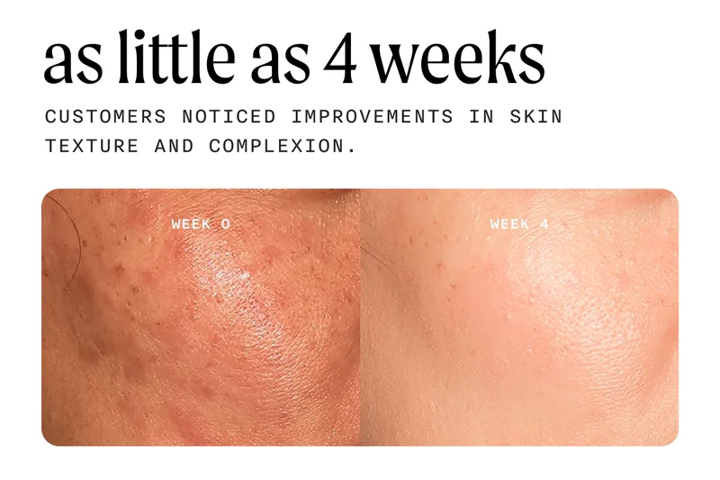 As little as 4 weeks - Customers noticed improvements in skin texture and complexion.