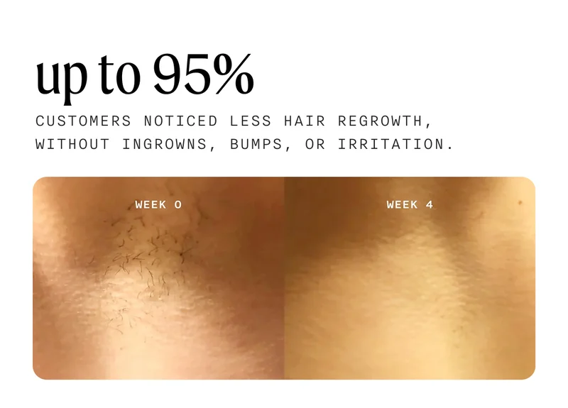 up to 95% - Customers noticed less hair regrowth, without ingrowns, bumps, or irritation.