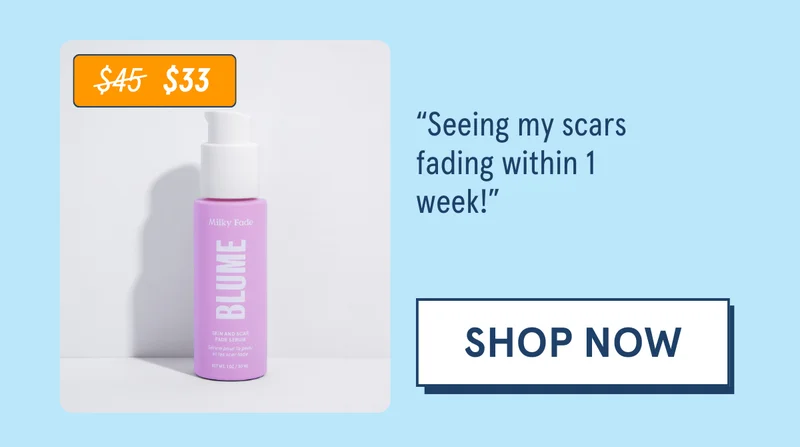 “Seeing my scars fading within 1 week!” [SHOP NOW]