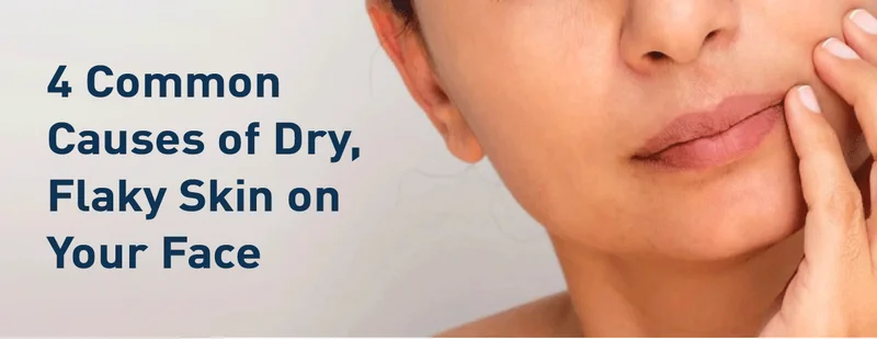 4 Common Causes of Dry, Flaky Skin on Your Face