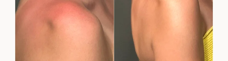 Before and after