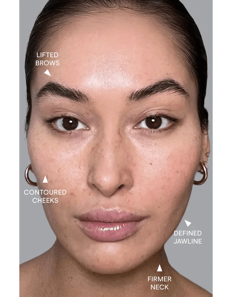 Defined jawline. Contoured cheeks. Firmer neck. Lifted brows.