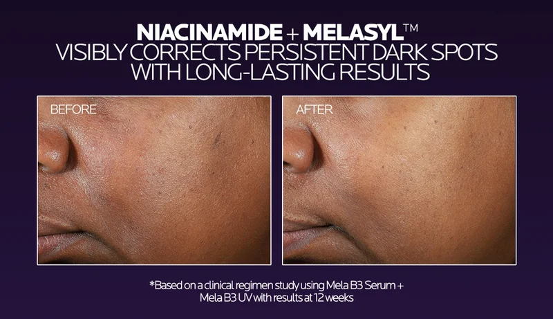 NIACINAMIDE + MELASYL