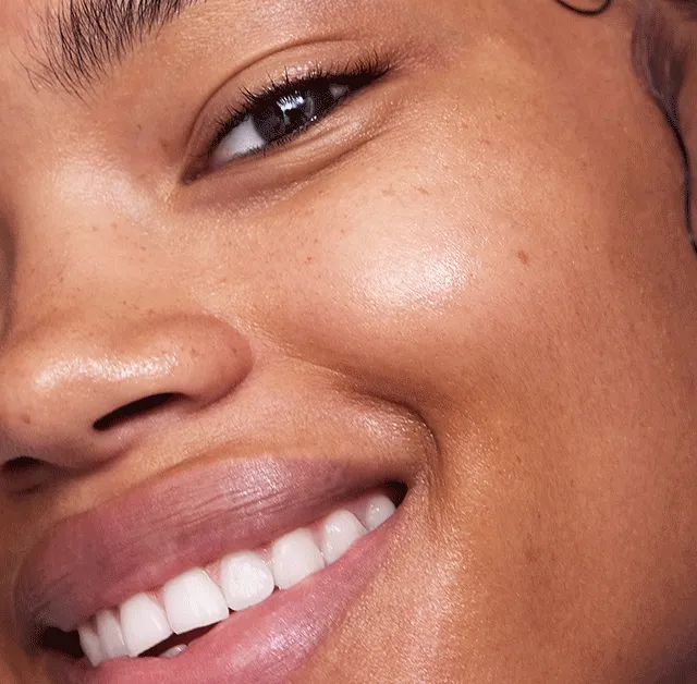 it's winter skin relif day.