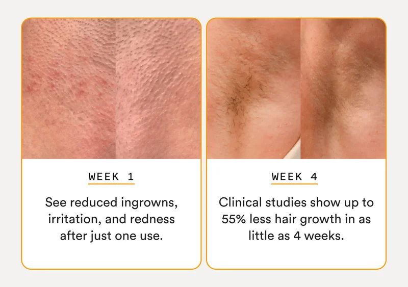 Week 1: See reduced ingrowns, irritation, and redness after just one use. - Week 2: Clinical studies show up to 55% less hair growth in as little as 4 weeks.