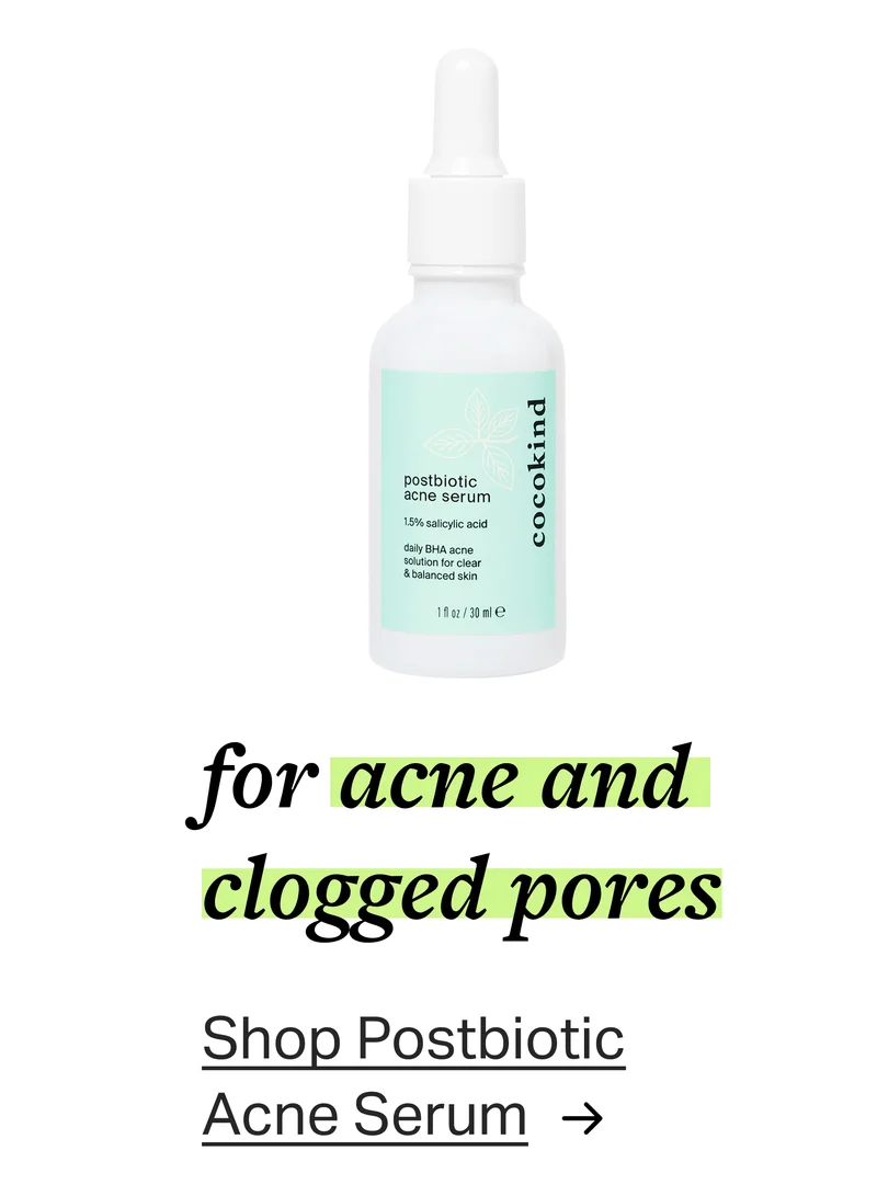 for acne and clogged pores Shop Postbiotic Acne Serum