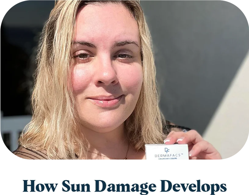 How Sun Damage Develops