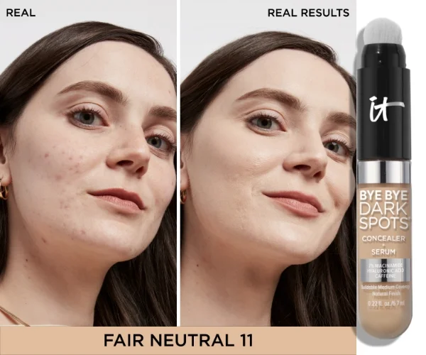 BYE BYE DARK SPOTS CONCEALER + SERUM