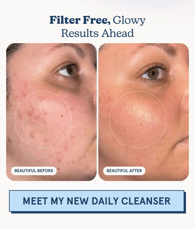 Filter Free, Glowy Results Ahead [MEET MY NEW DAILY CLEANSER]