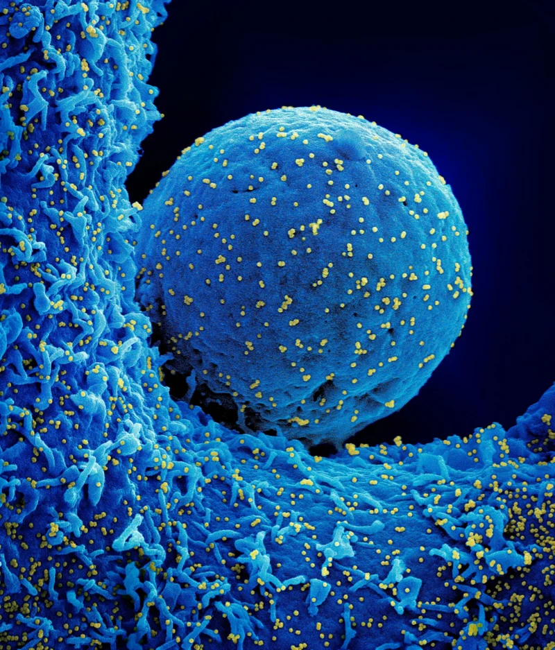 A colorized scanning electron micrograph of a cell (blue) infected with the Omicron strain of the&nbsp;SARS-CoV-2 virus (yellow).