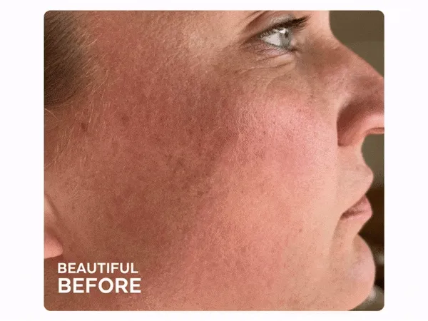 Beautiful Before and After