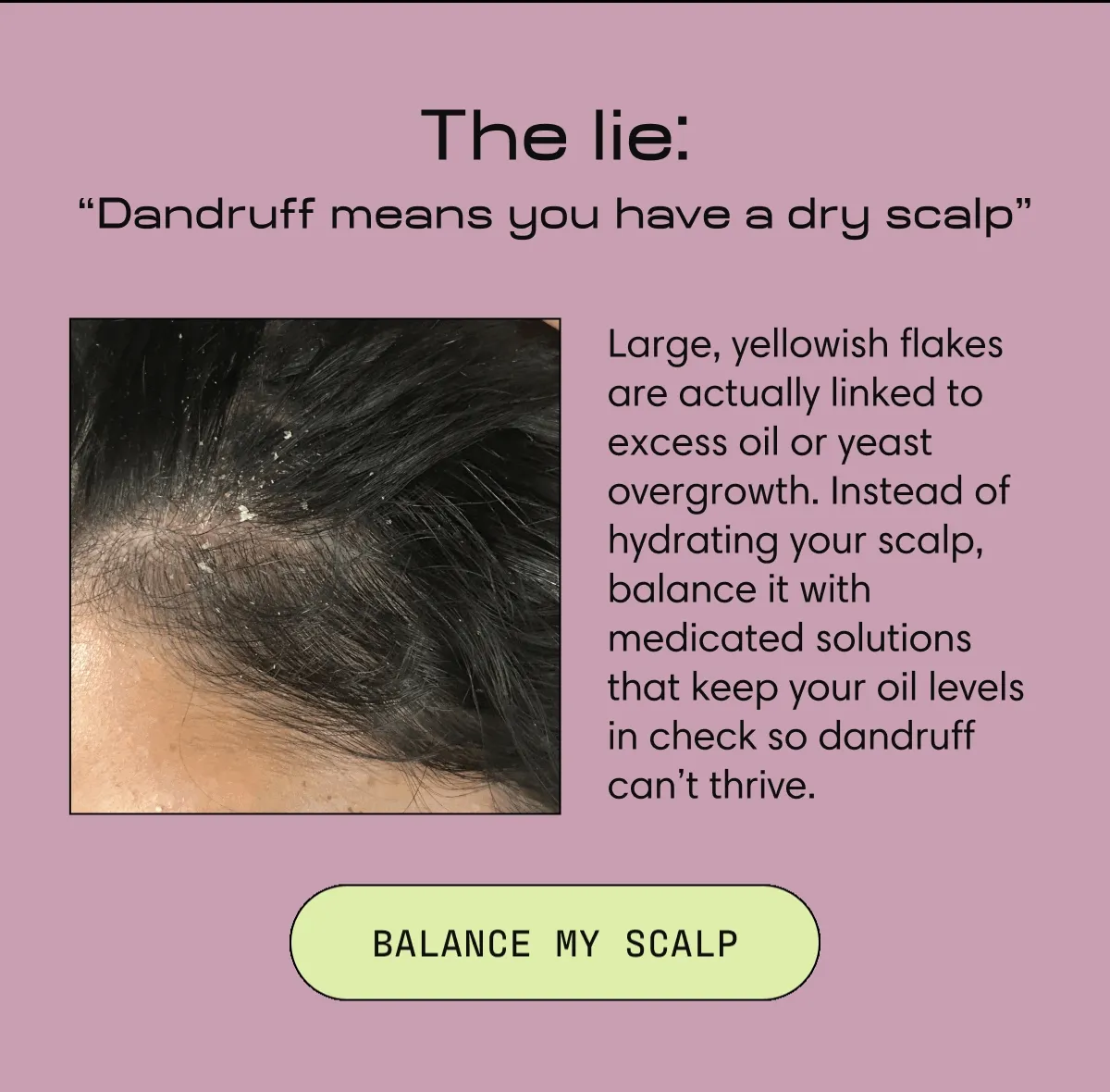 The lie: “Dandruff means you have a dry scalp” | Large, yellowish flakes are actually linked to excess oil or yeast overgrowth. Instead of hydrating your scalp, balance it with medicated solutions that keep your oil levels in check so dandruff can’t thrive. | Balance my Scalp