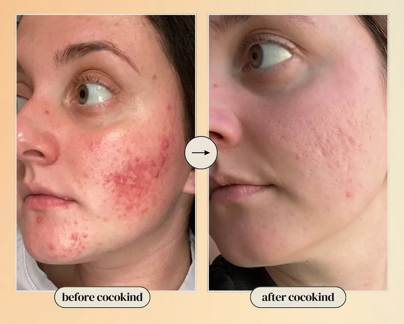 before/after