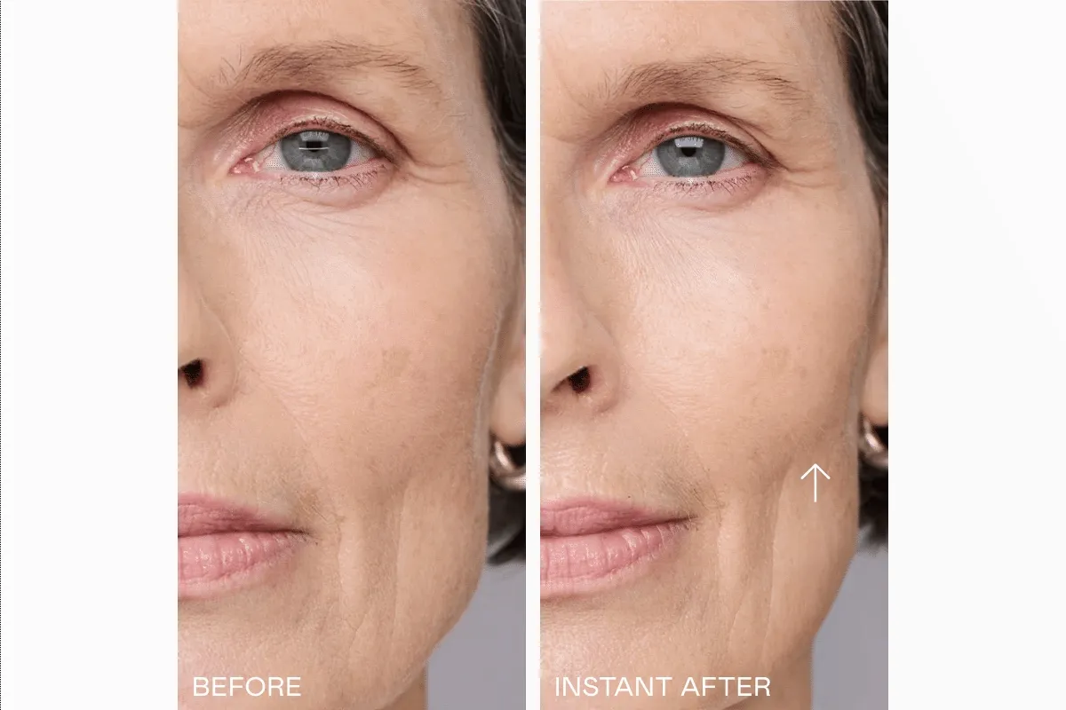 Before & After