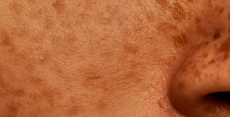 New: Skin Health
