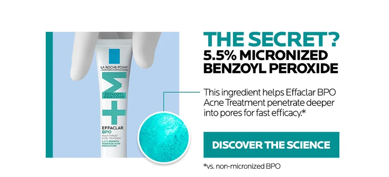 Discover the science of 5.5% micronized benzoyl peroxide