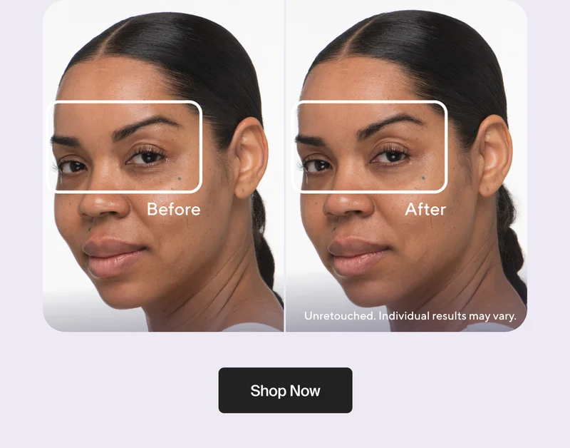 Unretouched. Individual results may vary. | Shop Now