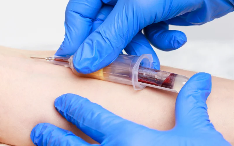 A needle being inserted into a patient’s arm