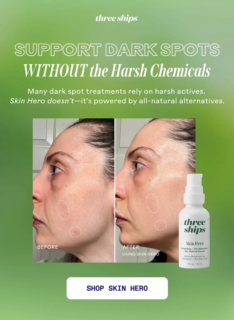 Support Dark Spots without the Harsh Chemicals. Shop Skin Hero