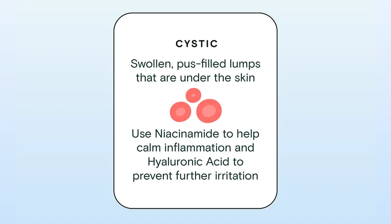 Cystic: Swollen, pus-filled lumps that are under the skin. Use Niacinamide to help calm inflammation and Hyaluronic Acid to prevent further irritation.