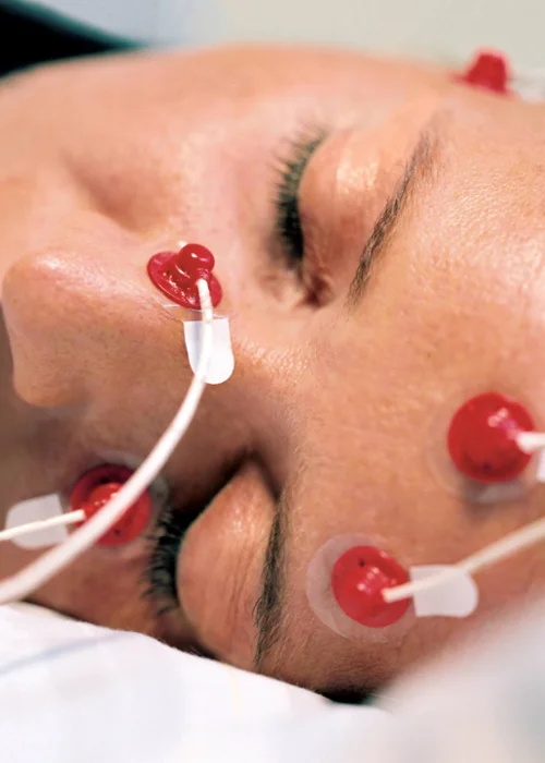 Researchers record brainwaves along with muscle and eye movements at a sleep lab in Germany.