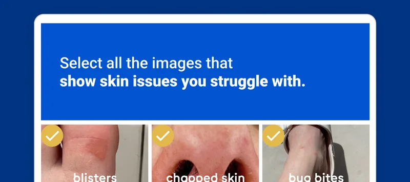 Select all the images that show skin issues you struggle with