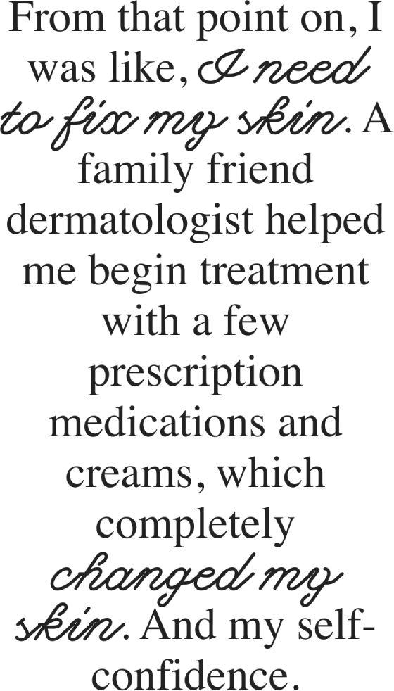 From that point on, I was like, I need to fix my skin. A family friend dermatologist helped me begin treatment with a few prescription medications and creams, which completely changed my skin. And my self-confidence.