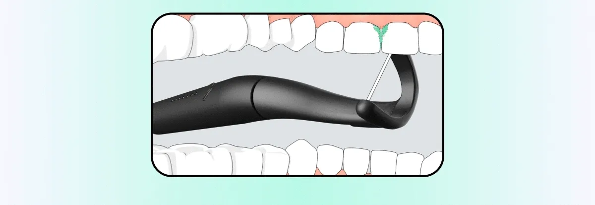 "The patented sonic vibrations create a left-to-right displacement motion that: Wiggles the floss between tight contacts, speeding up the process; Massages your gums, which helps to prevent gum disease; and Disrupts and dislodges plaque, food and bacteria.”