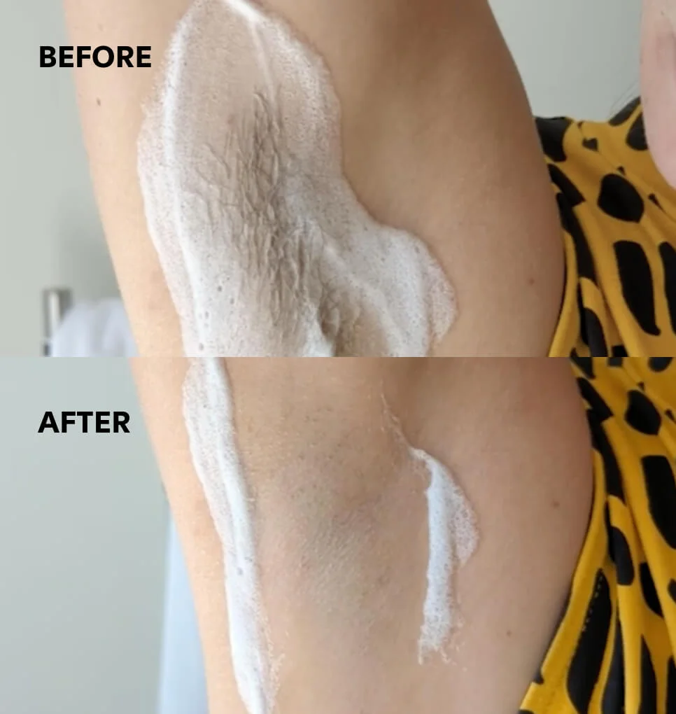 Women's underarm before and after shaving