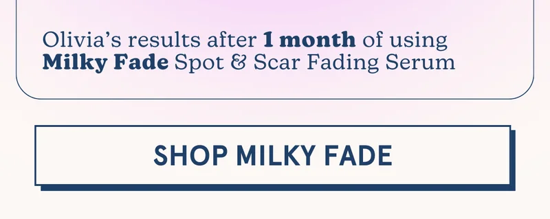 Olivia’s results after 1 month of using Milky Fade Spot & Scar Fading Serum [SHOP MILKY FADE]